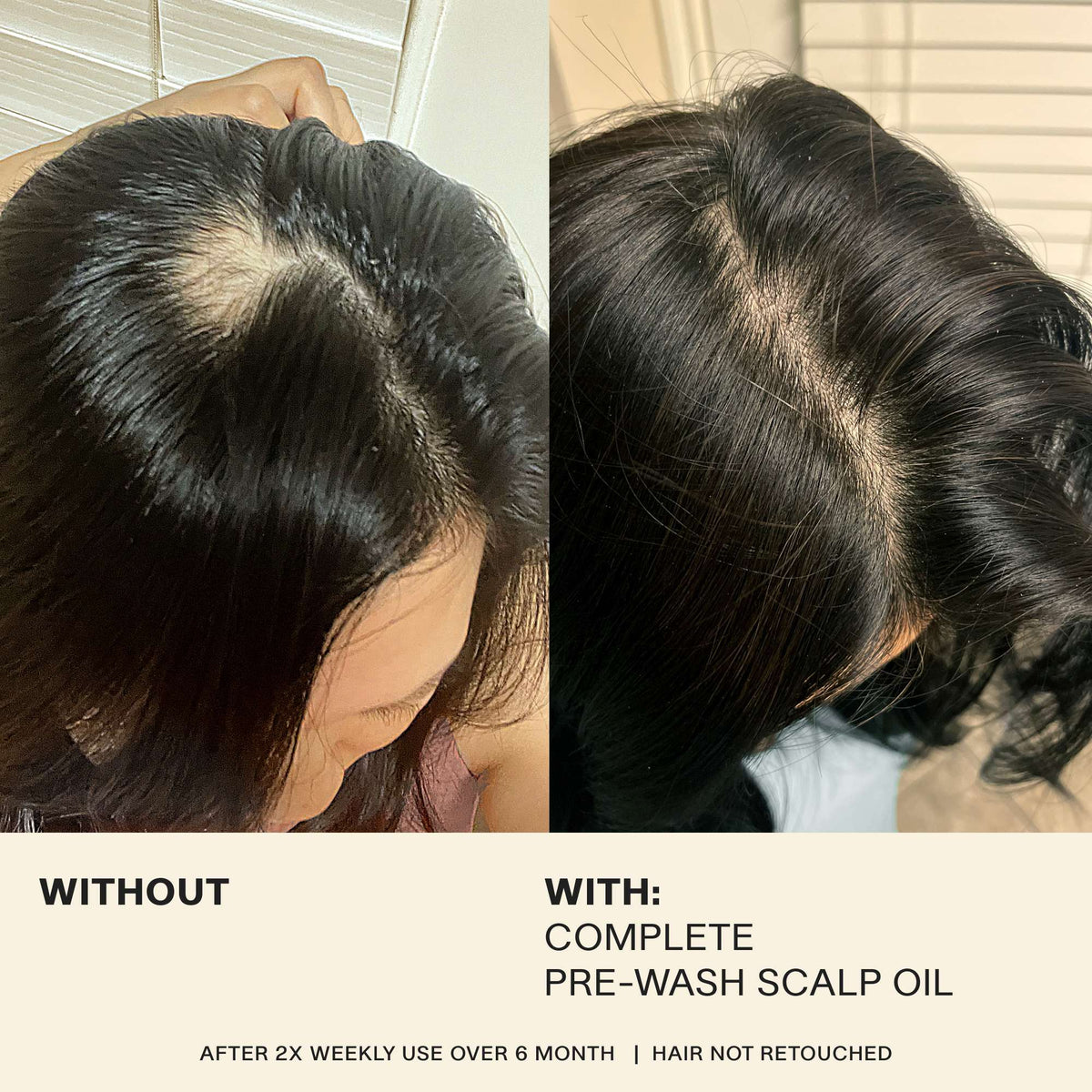 JVN Pre-Wash Scalp Oil | Rosemary-Infused Scalp Treatment